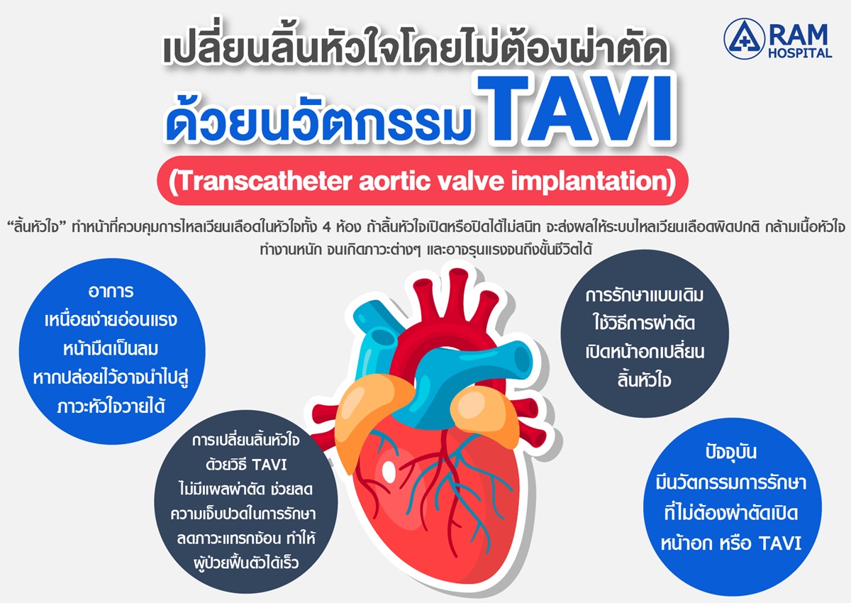 เปลี่ยนลิ้นหัวใจโดยไม่ต้องผ่าตัด ด้วยนวัตกรรม TAVI