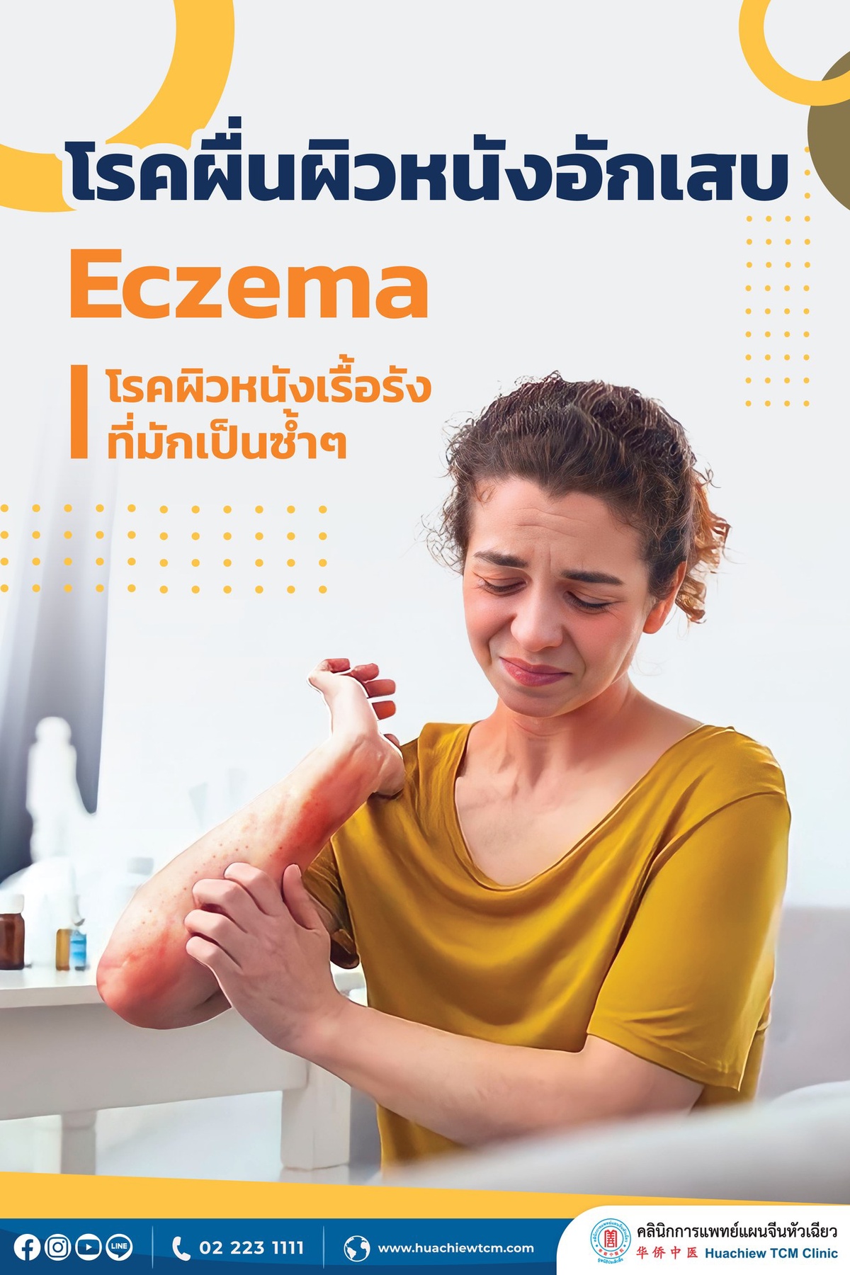 โรคผื่นผิวหนังอักเสบ (Eczema) ป้องกันและรักษาได้ด้วยการแพทย์แผนจีน โดย คลินิกการแพทย์แผนจีนหัวเฉียว