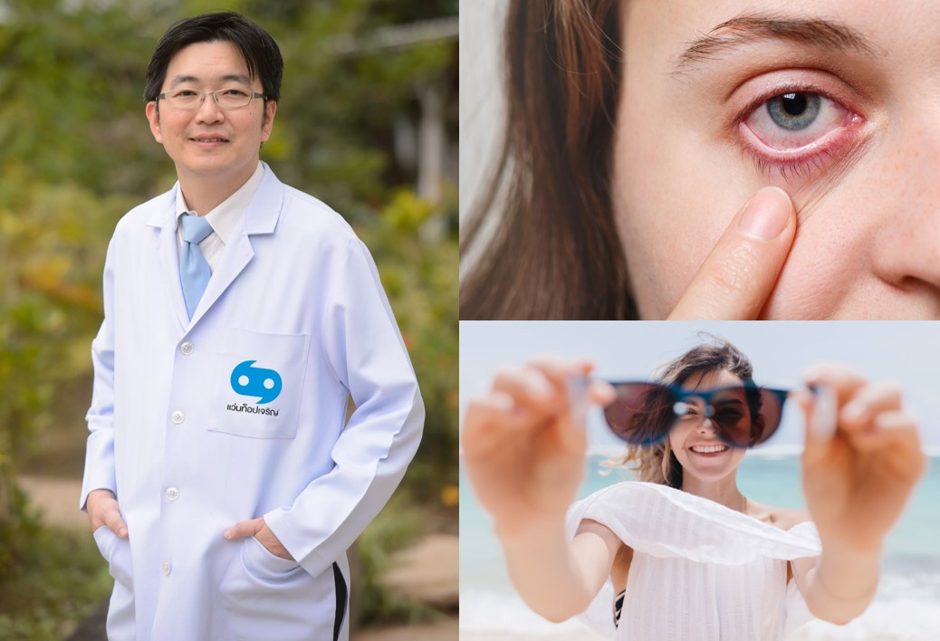จักษุแพทย์แว่นท็อปเจริญ แนะช่วงฤดูร้อนระวังโรคลมแดดแล้ว ยังเสี่ยงกลุ่มโรคทางตาด้วย
