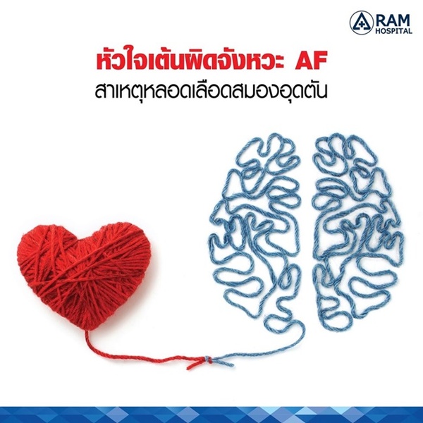 หัวใจเต้นผิดจังหวะ AF สาเหตุหลอดเลือดสมองอุดตัน