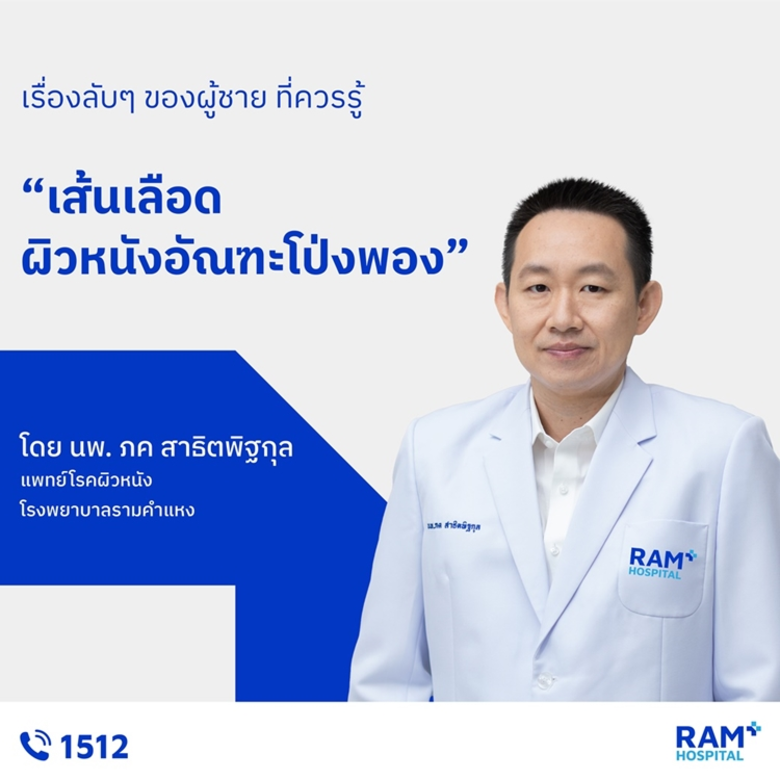 เรื่องลับๆ ของผู้ชาย ที่ควรรู้ : เส้นเลือดผิวหนังอัณฑะโป่งพอง