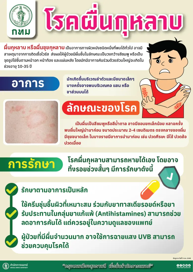 กทม. รุกเข้มเฝ้าระวังโรคผื่นกุหลาบ แนะวิธีป้องกันตนเอง ลดความเสี่ยงแพร่ระบาด