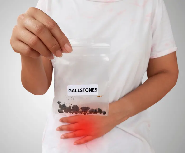 ถุงน้ำดีอักเสบ ทำไมแพทย์บางคนบอกให้รอ บางคนให้ผ่าตัดเลย แล้วเราจะเชื่อใครดี?