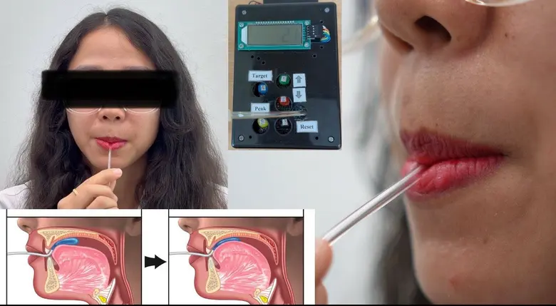 จุฬาฯ เปิดตัว CUPTI นวัตกรรมเครื่องวัดแรงลิ้นต้นแบบฝีมือนักวิจัยไทย ราคาประหยัด เพื่อผู้ป่วยเข้าถึงได้