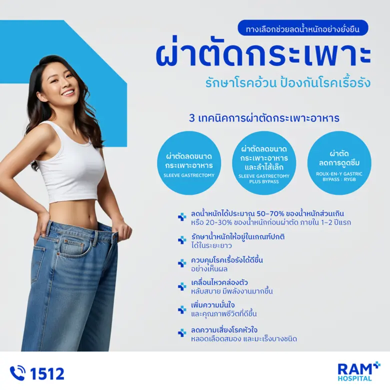 "ผ่าตัดกระเพาะ" ทางเลือกช่วยลดน้ำหนักอย่างยั่งยืน รักษาโรคอ้วน ป้องกันโรคเรื้อรัง
