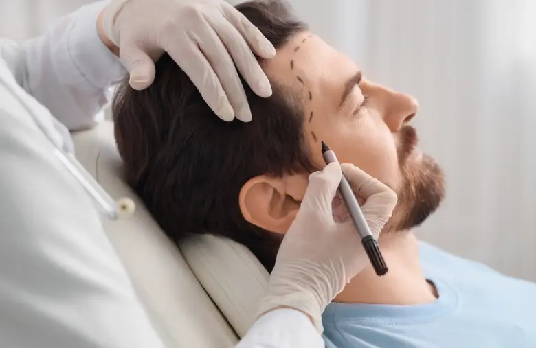 แชร์วิธีการเลือกเทคนิคปลูกผมให้ตอบโจทย์ และเห็นผลลัพธ์มากที่สุด