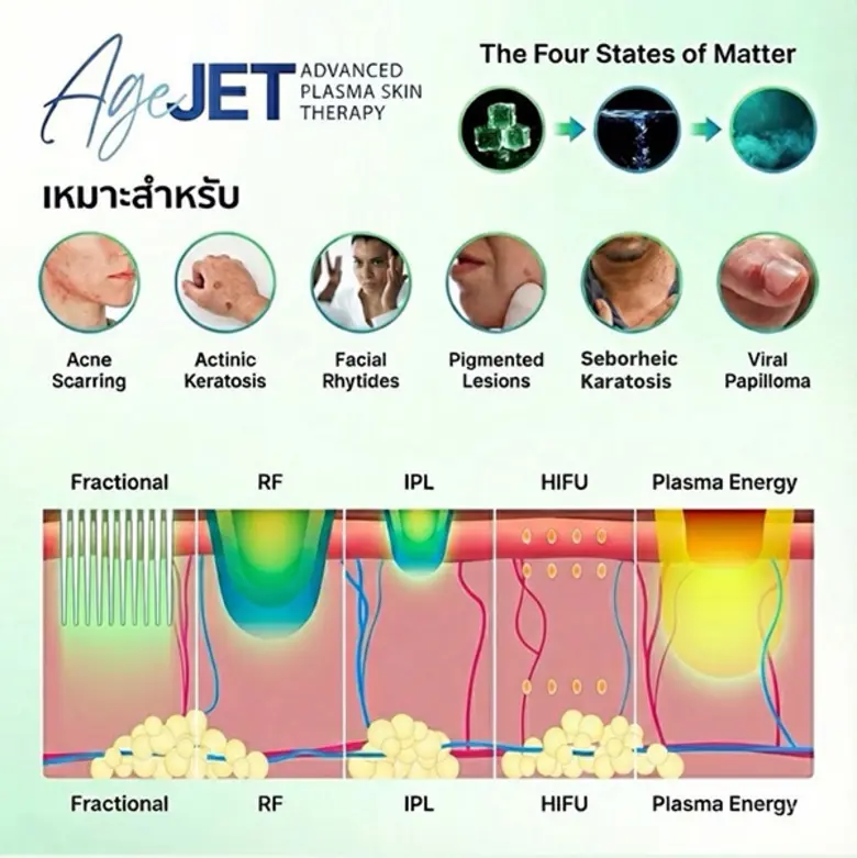 เปิดตัวพลาสมา นวัตกรรมความงามใหม่ล่าสุด จัดการปัญหาผิวหลังการทำเลเซอร์