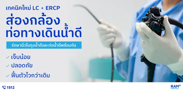 เทคนิคใหม่ LC + ERCP ส่องกล้องท่อทางเดินน้ำดี รักษานิ่วในถุงน้ำดีและท่อน้ำดีพร้อมกัน