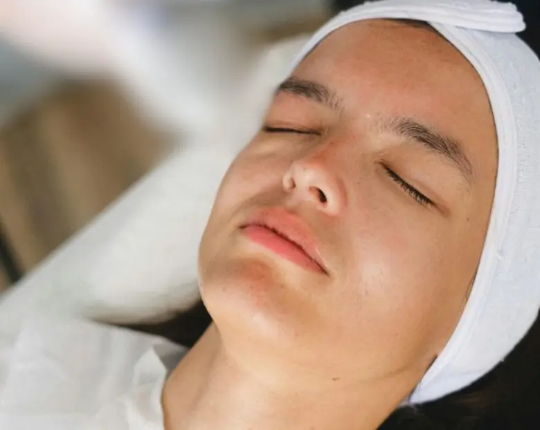 วีบีม เลเซอร์ (Vbeam Laser) รักษารอยแดงจากสิว ทำแล้วผิวบางจริงไหม