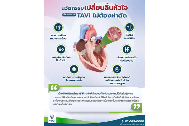 เหนื่อยง่าย นอนหงายแล้วอึดอัด อาจเสี่ยง "โรคลิ้นหัวใจ" แพทย์ รพ.วิมุต ชู "TAVI" ทางเลือกใหม่ นวัตกรรมซ่อมลิ้นหัวใจไม่ต้องผ่าตัดเปิดหน้าอก