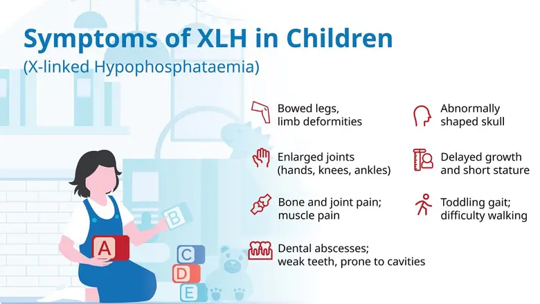 Thai Society for Pediatric Endocrinology and DKSH Raise Awareness of Rare Genetic Bone Disorder XLH