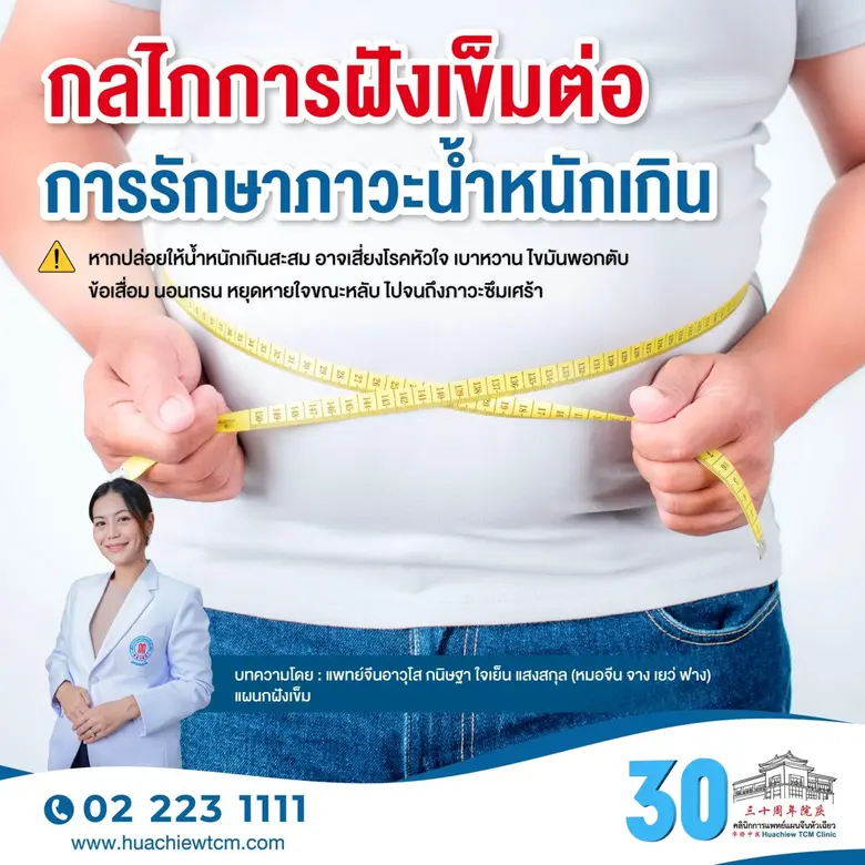 เข้าใจกลไกการฝังเข็มกับการดูแลภาวะน้ำหนักเกิน