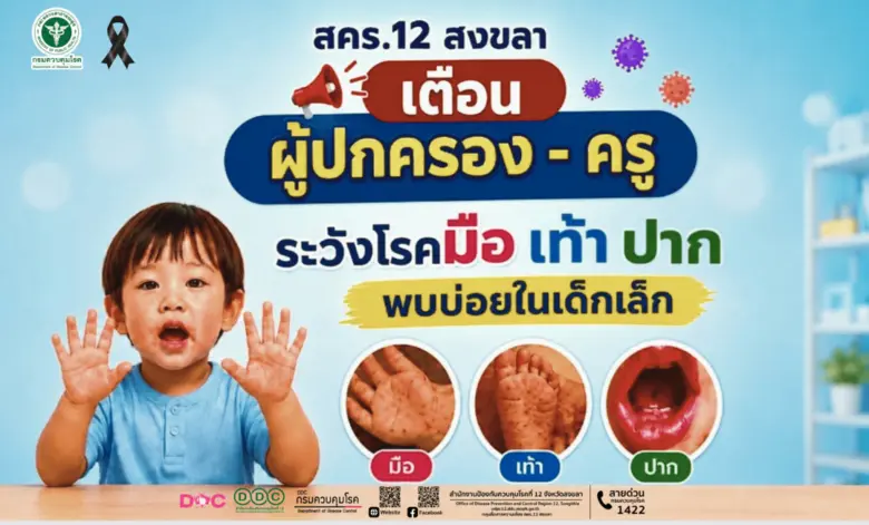 สคร.12 สงขลา เตือนผู้ปกครอง - ครู ระวังโรคมือ เท้า ปาก พบบ่อยในเด็กเล็ก