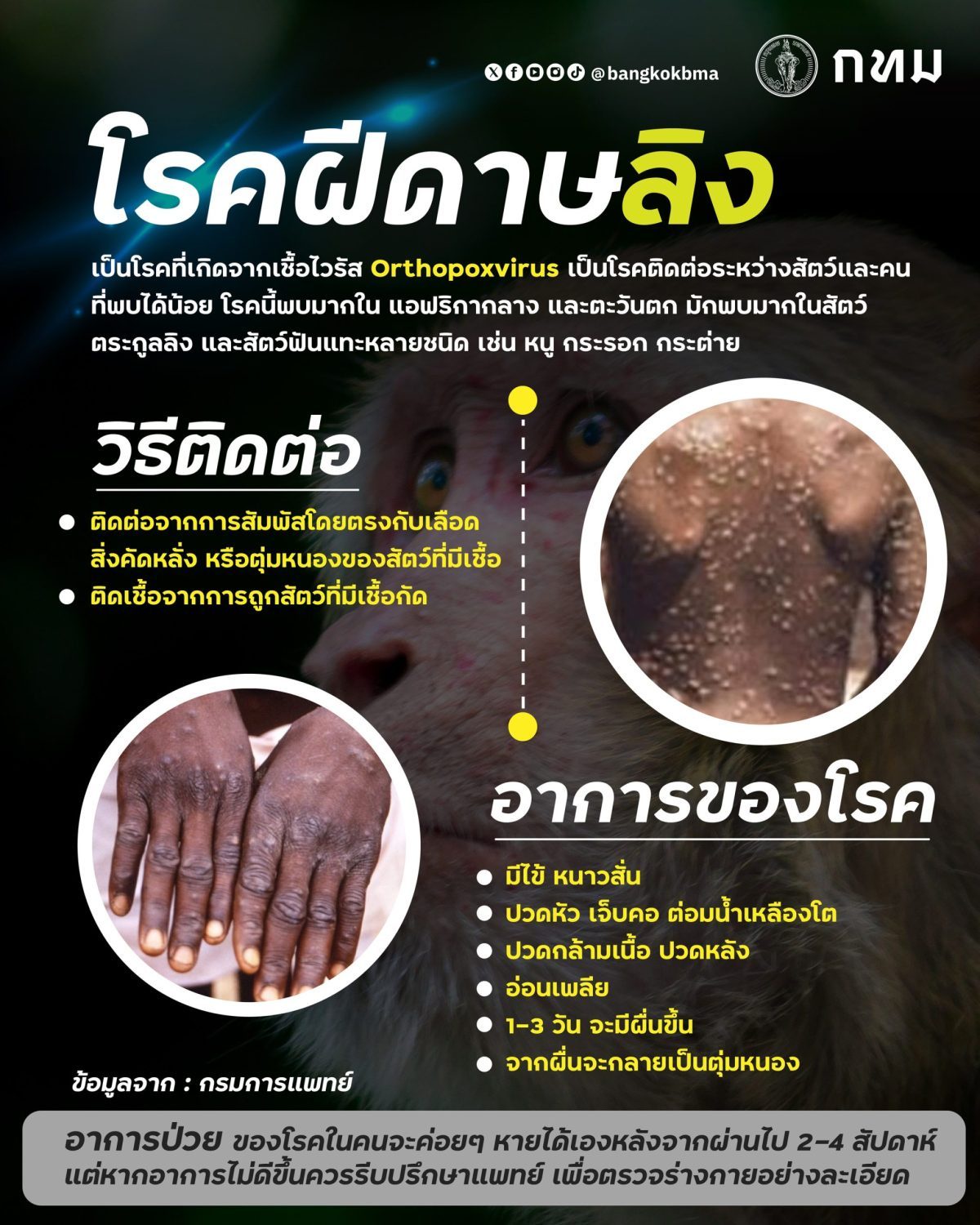 กทม. เน้นย้ำมาตรการเฝ้าระวังป้องกันการแพร่ระบาดโรคฝีดาษลิงในกรุงเทพฯ