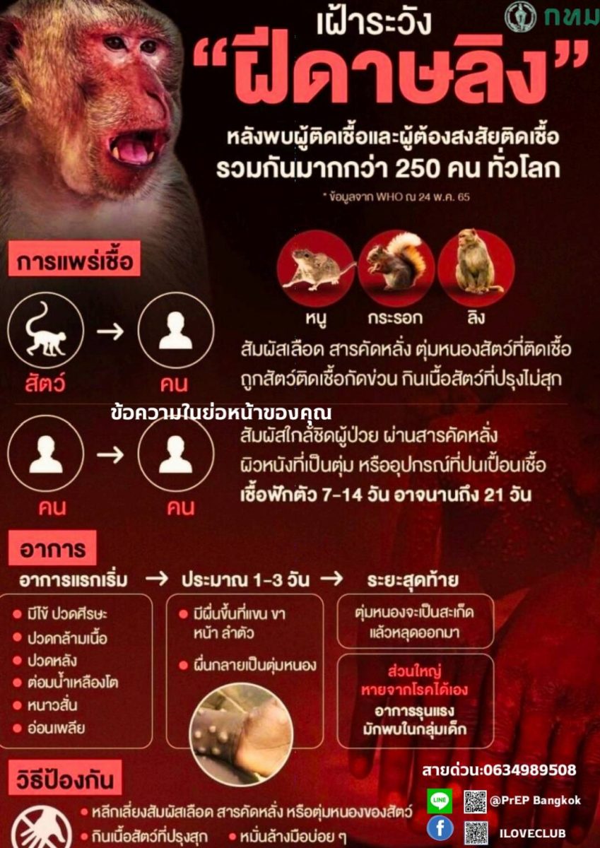 กทม. เตรียมพร้อมมาตรการเฝ้าระวัง-ป้องกันการแพร่ระบาดโรคฝีดาษลิงในกรุงเทพฯ